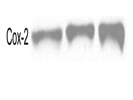 Consistent Detection Of Cox-2 In Mouse Peritoneal Macrophages