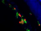 Good Antibody To Detect IL33 By Immunostaining