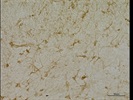 Immunostaining Of Mouse Brain With HO-1 Antibody From Enzo Life Sciences