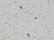 Try Aggregate-Specific Antibodies for &alpha;-Synuclein from BioLegend