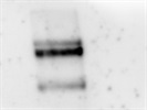 Rabbit VEGF-R2 antibody for Western Blot