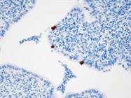 Quality Kit For Blocking Endogenous Steptavidin/Biotin