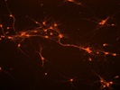 Best Antibody For MAP2