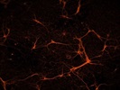 Good Dendrite Marker