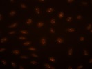 Great Antibody To Use As A Nucleolus Marker