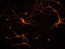 Dendrite Marker: beta-3 Tubulin Antibody