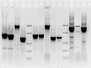 Get Out of the Dark(room) with these Western Blotting Documentation Systems