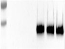 Good Antibody Against IGFBP2