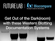 Get Out of the Dark(room) with these Western Blotting Documentation Systems