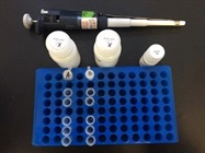 QIAGEN Column DNA Extraction From Whole Blood