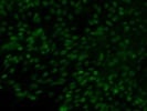 Detect Sox9 In Mouse Embryonic Stem Cells