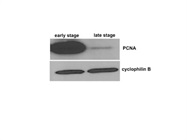 Detection Of PCNA In Primary Tumor Cells By Immunoblotting