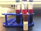 Anti-CD-62P-AF647 Ab For The Detection Of Activated Human Platelets By Flow Cytometry