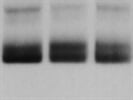 Excellent Antibody For Detection Of Human BRAF Protein