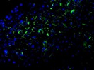 Laminin Alpha 2 Antibody