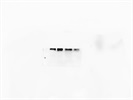 Antibody To Detect Cleaved Notch 1