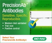 Validated Western Blotting Antibodies That Work Every Time