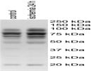 Anti-RIP1 Antibody (4926)