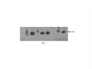 IL-5 Monoclonal Antibody