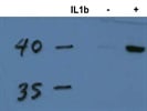 Clear Bands at the Expected Size