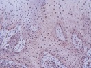 RAMP2 In Epithelial Tissue