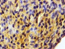 Anti-Apolipoprotein A1 Antibody
