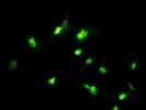 Vimentin: The Marker For Stromal Cells