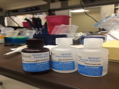 Normalization Of Western Blots Using Total Protein Stain | Biocompare ...