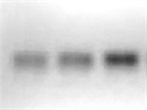 Sorcin Antibody