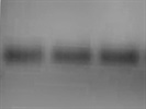 Anti HSP-27 Antibody