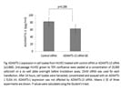 Human ADAMTS1 PicoKine  ELISA Kit Worked Well