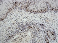 POLYVIEW PLUS Reagents