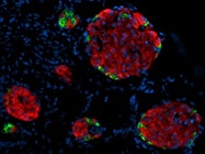 Reliable Antibody For Insulin Staining