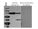 Anti C-terminal CD44 Antibody
