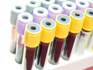 Unleashing the Potential of Liquid Biopsy with Flow Cytometry