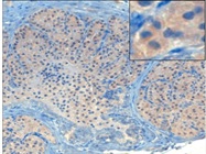 pAkt in Mouse Prostate Cancer Model