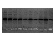 Horizontal Electrophoresis For Nucleic Acids