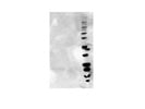 Vertical Electrophoresis