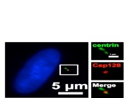 Cep128 Antibody Works Fine for Immunofluorescence