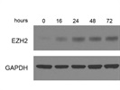 Detection Of Murine EZH2- T Lymphocytes