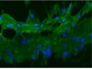 ZO-1 Immunofluorescence Staining