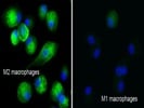 Good Antibody To Detect Macrophage Mannose Receptor (MMR, CD206) On Mature Human Macrophages