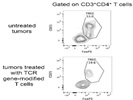FoxP3 Staining To Detect Tregs In Tumor Microenvironment
