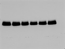 JamA Levels In Human Aortic Endothelial Cells
