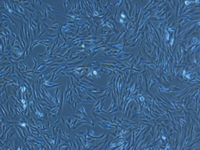 SUM159 Cells | Biocompare.com Kit/Reagent Review