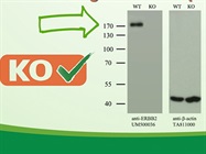 Watch Video: Antibody Specificity and KO Lysate from OriGene Technologies