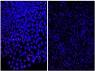 Advantages of Working with NaÏve Pluripotent Stem Cells