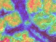 Mass Spec Advances Chip Away at Proteomics Challenges