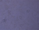 MDA-MB-231 Cells For Cancer Experiments