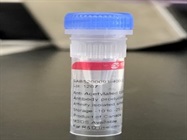 Time Course Effect Of Chemoattractant On Acetylation Of PPARgamma
